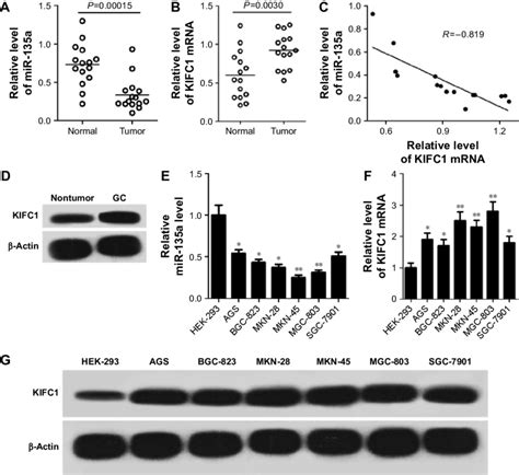 Mir 135a Is Downregulated And KiFc1 Is Upregulated In Gc Notes A And