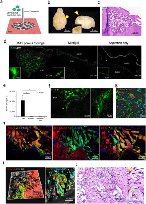 Stepwise Transplantation Of Gfp Labeled Nscs Into The Implanted C A