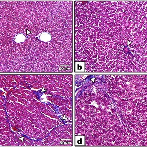 Photomicrographs Of Liver Sections Stained By Mt Stain In A Control And Download Scientific