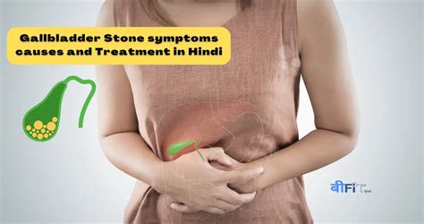 Gallstones or Gallbladder Stone in Hindi कय आप भ ह पतत क थल