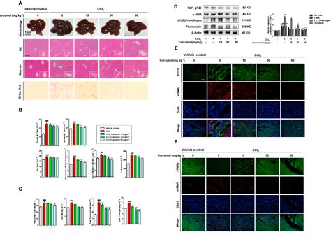 Figure 1 From Curcumol Induces RIPK1 RIPK3 Complex Dependent