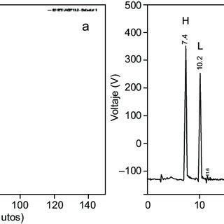 An Lisis De Cromatograf A L Quida De Alta Resoluci N Hplc Por Su