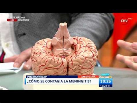 Todo lo que debe saber sobre la meningitis síntomas cómo se contagia