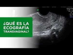 Descubre Todo Sobre La Ecograf A Transvaginal Qu Es C Mo Se Realiza