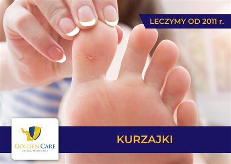 Kurzajki I Brodawki Poradnik Golden Care