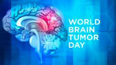 World Brain Tumor 2023 Know The Date History And Importance Here