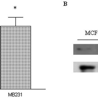 Enzymatic Activity And Expression Levels Of PKM2 Were Detected In Both