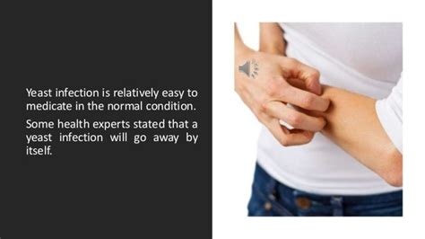 Can A Yeast Infection Go Away On Its Own? | PPTX