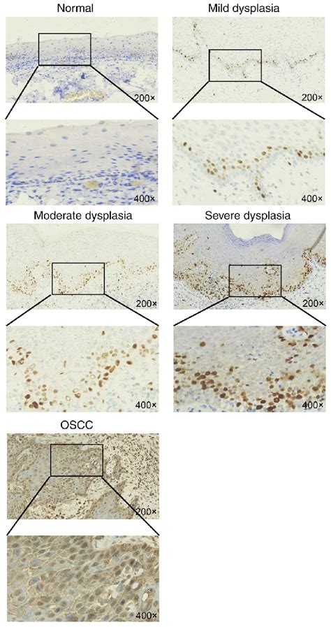 Immunohistochemical Staining Showing Expression Of Ki 67 In Normal Download Scientific Diagram