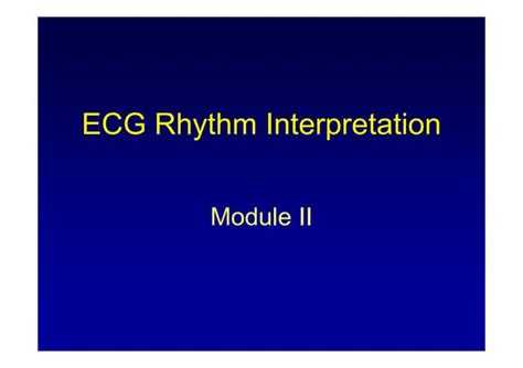 ECG Rhythm Interpretation (ECG Rhythm Analysis) | PPT