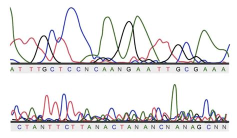 What Is Electropherogram How To Read It Genetic Education