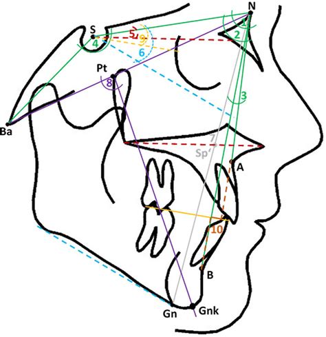 Skeletal Cephalometric Parameters Used As Guiding Predictor Variables Download Scientific