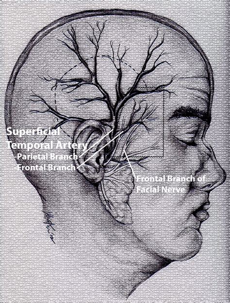 Temporal Artery Ultrasound