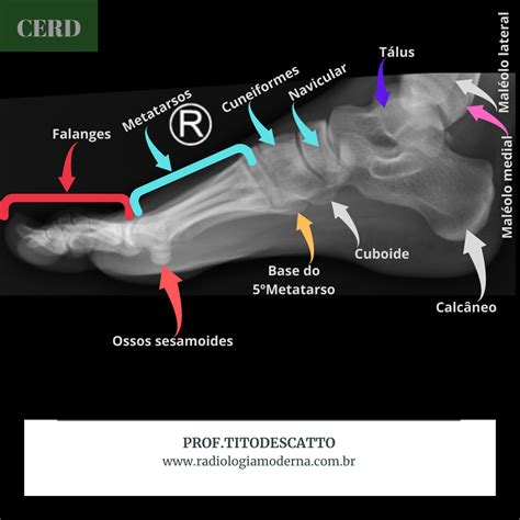 Pin Em Radiologia Geral