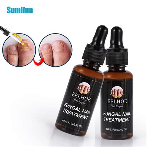 30ml Onychomycosis Treatment Oil Fungal Nail Repair Essence Serum Herbal Fungus Removal Gel Anti