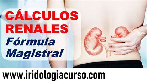 C Lculos Renales F Rmula Magistral Cenhnaturopatia Iridologia Youtube