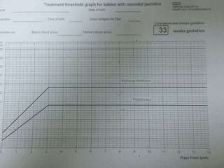 Physiological jaundice among newborns/ Icterus neonatorum | PPT