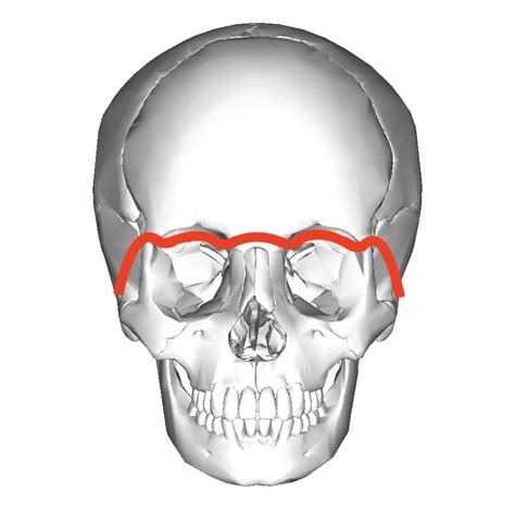 Le Fort Iii Guide Procedure Recovery And More Myface