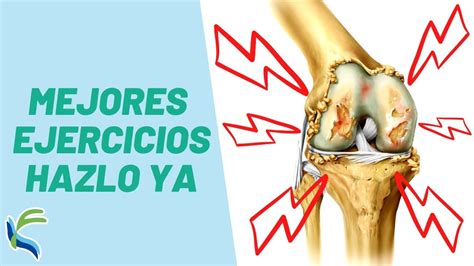 Sobre El Dolor De Rodilla Por Qu Me Duele Y Qu Puedo Hacer