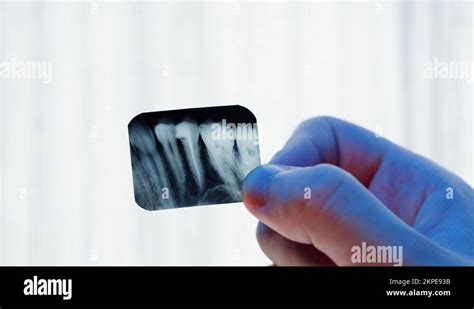 Teeth X Ray Close Up Doctor Examining Xray Of Tooth Magnetic