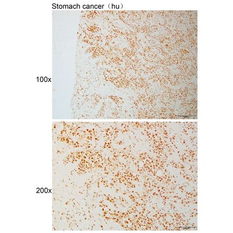 Solarbio K P Anti Pinx Polyclonal Antibody