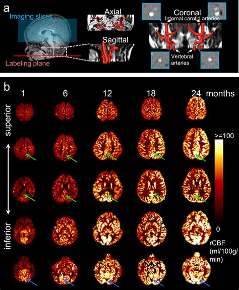 Figures And Data In Infant Brain Regional Cerebral Blood Flow Increases