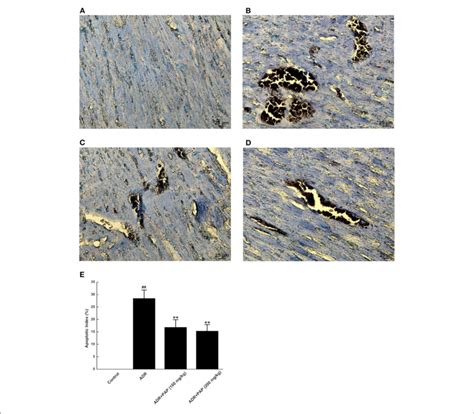 PAP 3 2KD Blocked The Apoptosis Of ADR Induced Myocardial Tissue