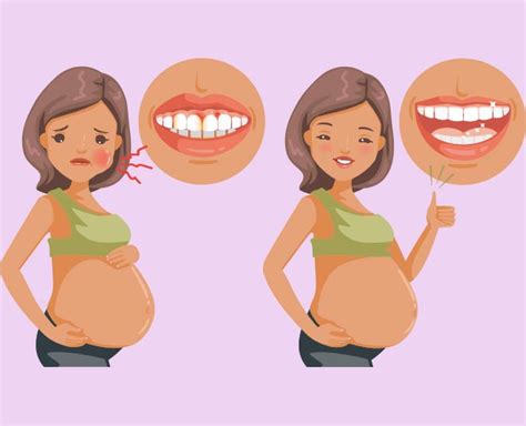 How To Maintain Dental Hygiene During Pregnancy How To Maintain