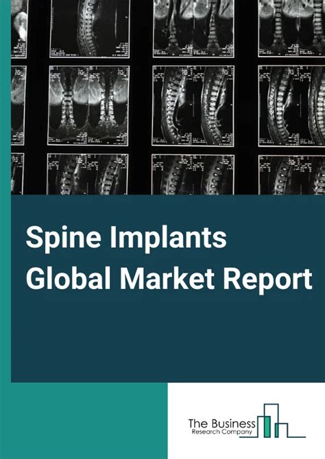 3D Printed Medical Devices Market Report 2024 3D Printed Medical