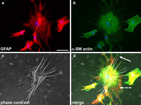 Expression Of Glial Fibrillary Acidic Protein Gfap Red And Smooth