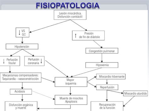 Shock Cardiogenico