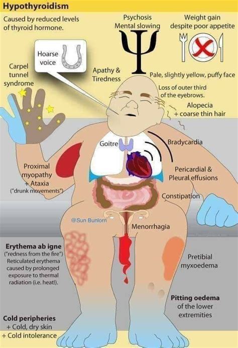 Pin By Aleksandra Stawik On Medyczne Medical School Essentials