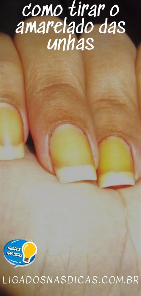 Porque A Unha Fica Amarela - Como Tirar O Amarelado Das Unhas | Ligados Nas Dicas | Nails at home ...