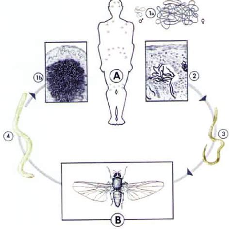 Abb 1 Entwicklungszyklus Von Onchocerca Volvulus A Endwirt Download Scientific Diagram