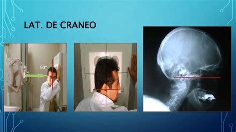 3 Proyecciones Radiograficas De DE CRANEO Pptx