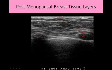 Breast Anatomy And Physiology Ultrasound Registry Review