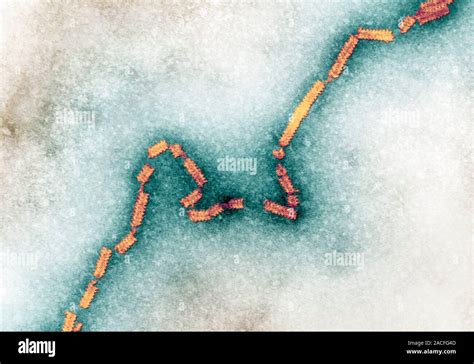 Human Parainfluenza Virus Transmission Electron Micrograph Tem Of Ribonuclear Protein Helices