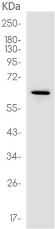 兔抗PRKAA1单克隆抗体 Anti PRKAA1 rabbit monoclonal antibody 生命科学产品与技术服务 生工生物工程