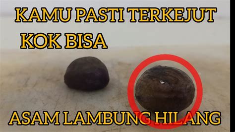 Sudah Terjamin Dan Mantap Asam Lambung Sembuh Karena Minuman Ini