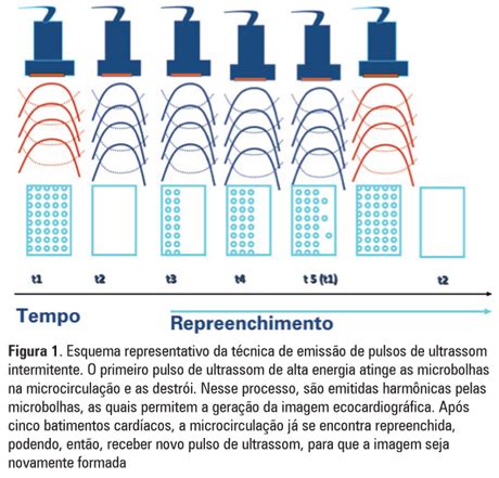 SciELO Brasil Ecocardiografia contraste no infarto do miocárdio