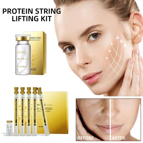 Facial Korean Protein Thread Lifting Set Face Filler Absorba Taobao