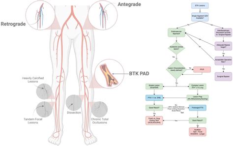 Surgical And Endovascular Therapies For Below The Knee Peripheral