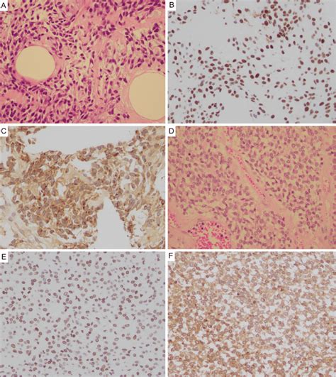 Figure2 Examination Of Biopsy Specimens Hematoxylin And Eosin Hande