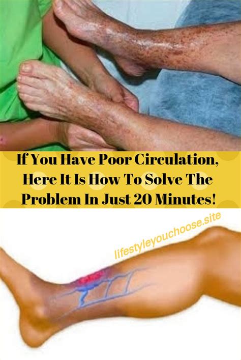 If You Have Poor Circulation Here It Is How To Solve The Problem In Just 20 Minutes Poor