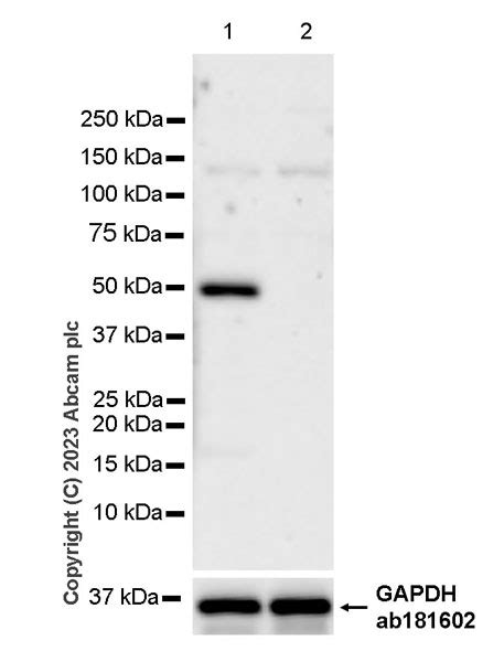 Anti Lipoprotein Lipase Antibody EPR28301 66 BSA And Azide Free