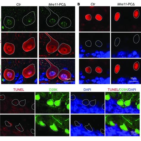 Deletion Of Nbs1 Is Compatible With Mouse Survival And Cerebellar