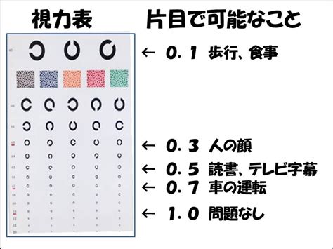 白内障の手術はどれぐらいの視力でした方がいい？ まつもと眼科 公式サイト。下関市東駅で日帰り白内障手術