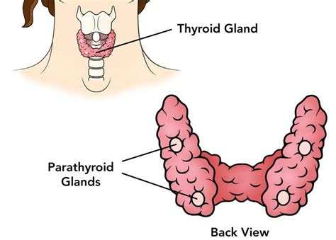 Hyperparathyroidism Symptom And Treatment Artofit