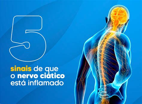 5 SINAIS QUE O NERVO CIÁTICO ESTÁ INFLAMADO