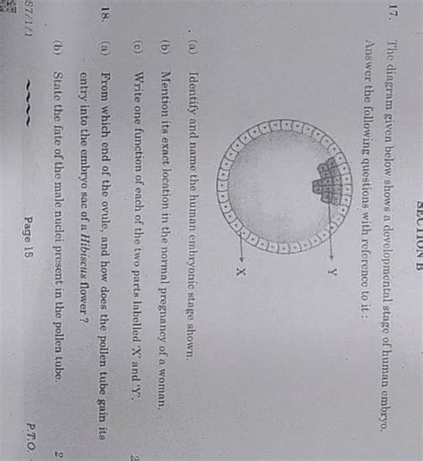 17 The Diagram Given Below Shows A Developmental Stage Of Human Embryo